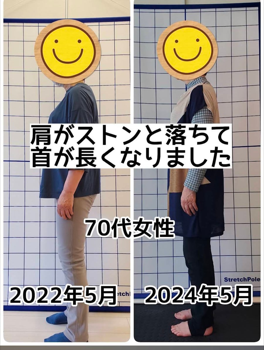 70代女性|肩がストンと落ちて、首が長くなりました