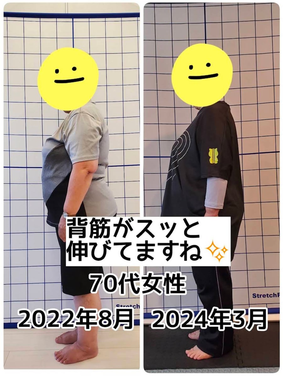 70代女性|背筋がスッと伸びました